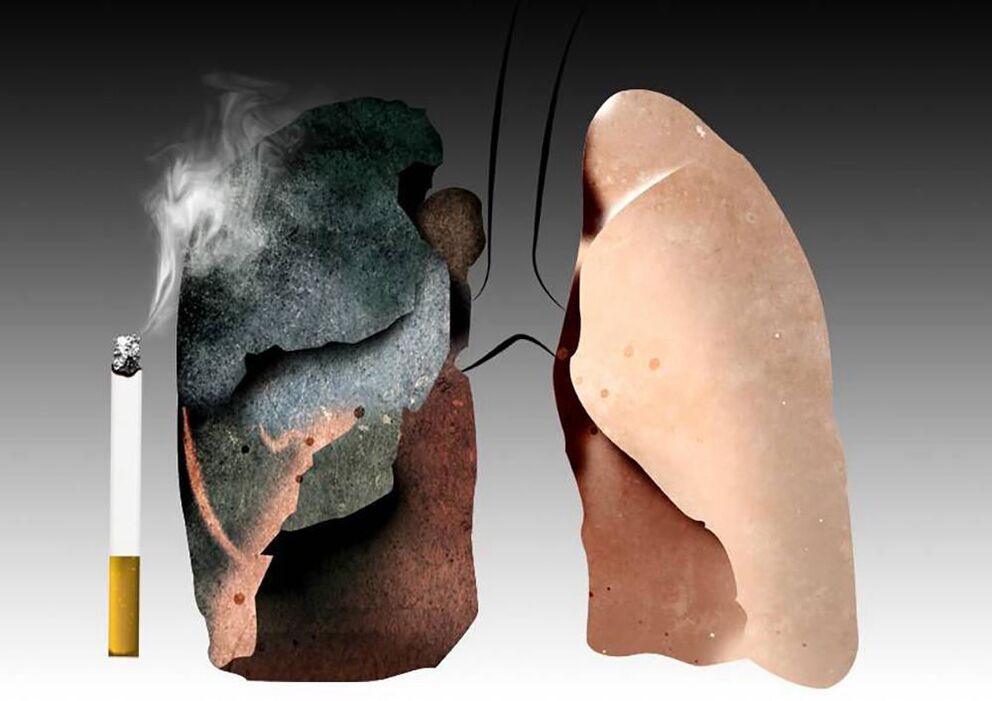 белите дробове на пушач